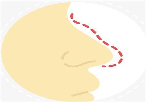 王蕊芳医生技术优势