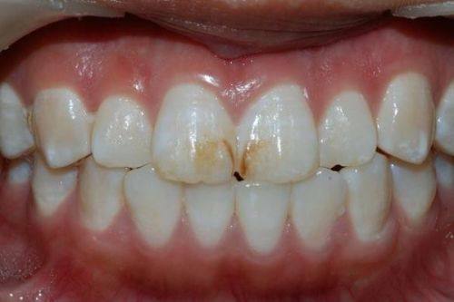 赵蔚琳医生执医荣誉