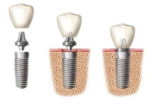 李慧平医生预约挂号