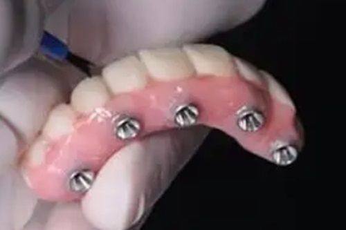 林慧明医生擅长项目