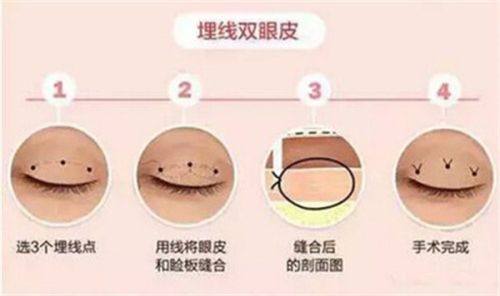 厦门思明华呈整形外科门诊部真人口碑评价怎么样？