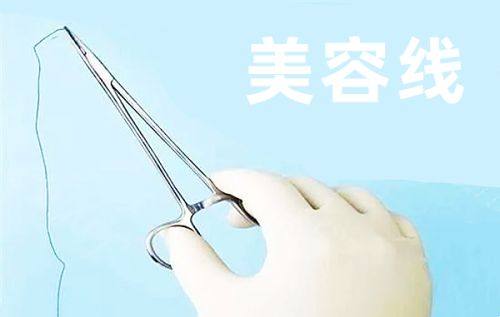 郭永信医生技术优势