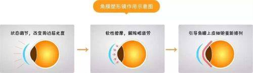 吴淑端医生口碑评价及真人实例