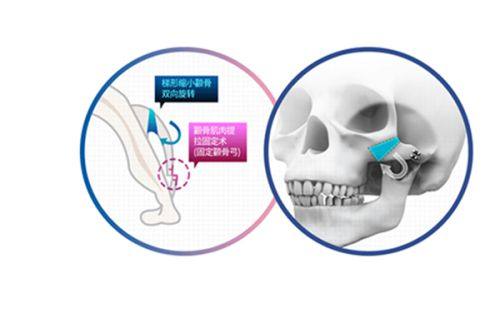 娄寅医生口碑评价及真人实例