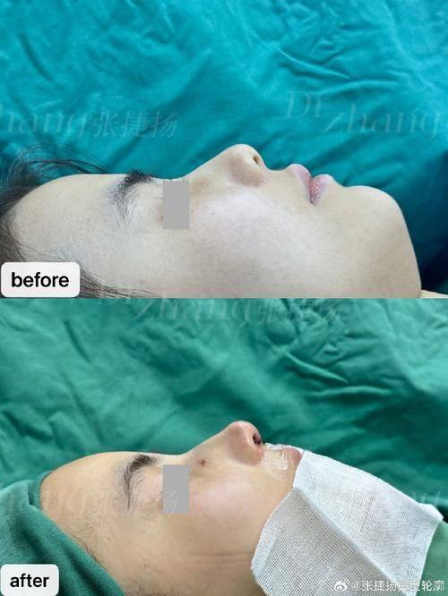 长沙俪尚佳美整形医院收费价格表/收费标准