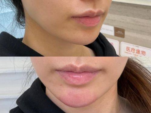 西安琥珀医疗美容诊所地址电话营业时间