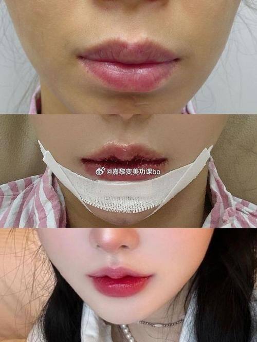 西安琥珀医疗美容诊所真人口碑评价怎么样？