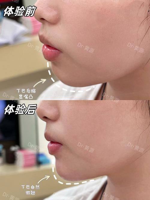 西安琥珀医疗美容诊所特色项目及技术优势