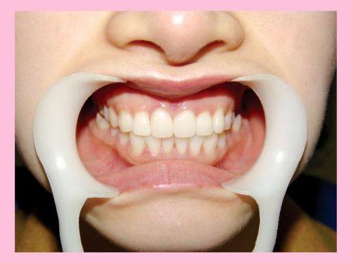 汕头为雅口腔真人口碑评价怎么样？