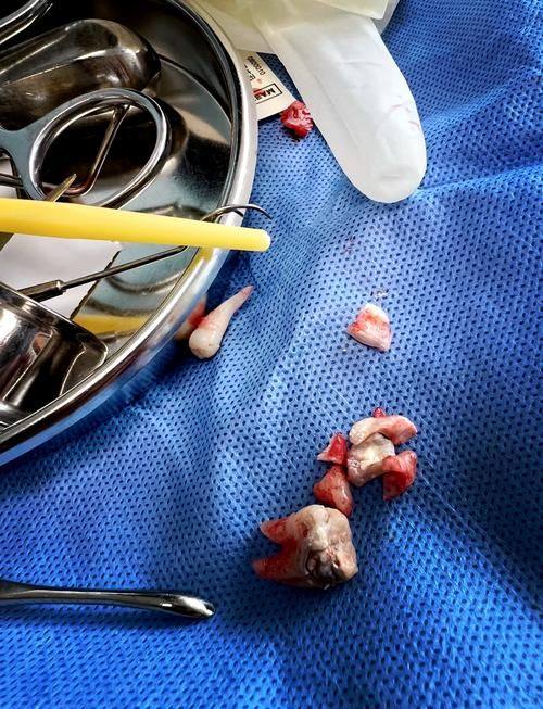 长沙市雨花区达飞口腔收费价格表/收费标准