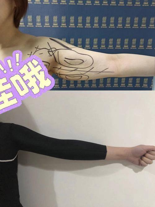 韩国劳波尔整形医院特色项目及技术优势