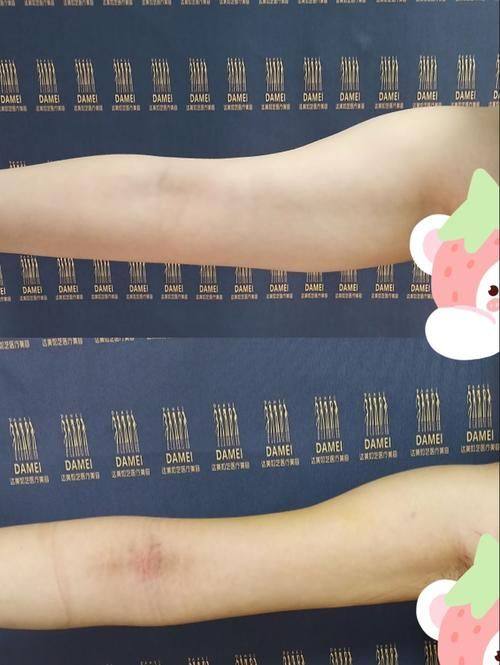 韩国劳波尔整形医院收费价格表/收费标准