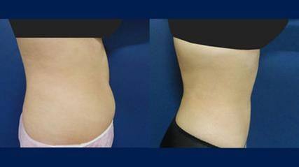 沈阳何丽蒙妮坦医疗美容诊所地址电话营业时间