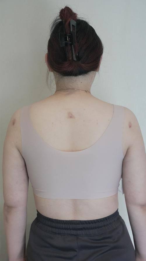 长沙俪尚佳美整形医院是正规医院吗？