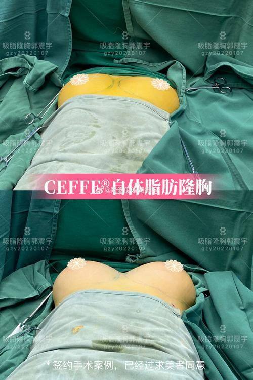 上海于彬医疗美容诊所真人口碑评价怎么样?