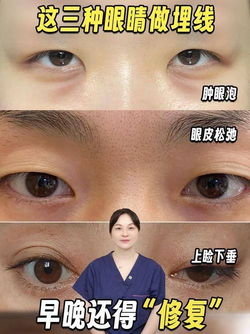 厦门思明华呈整形外科门诊部特色项目及技术优势