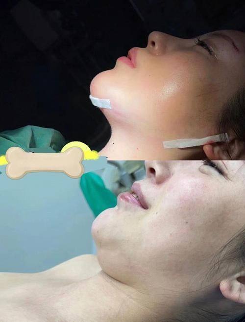 郑州喜美医疗美容门诊部特色项目及技术优势