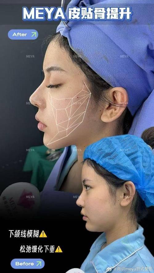 沈阳何丽蒙妮坦医疗美容诊所真人口碑评价怎么样?