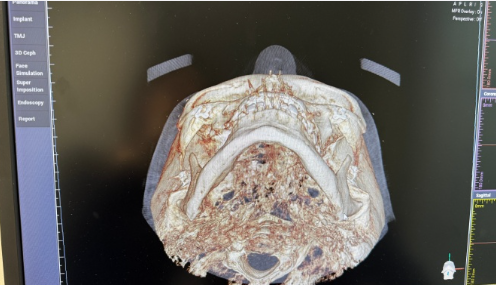 娄寅医生擅长项目