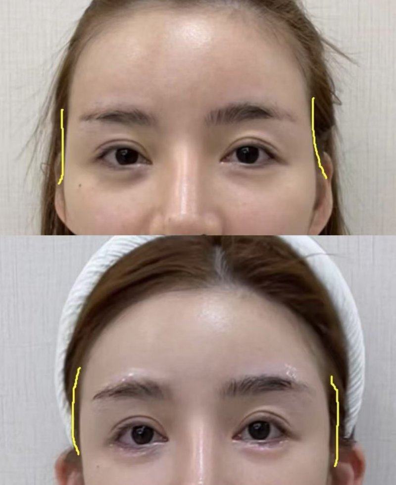 王蕊芳医生口碑评价及真人实例