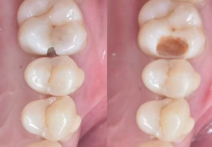 赵蔚琳医生口碑评价及真人实例