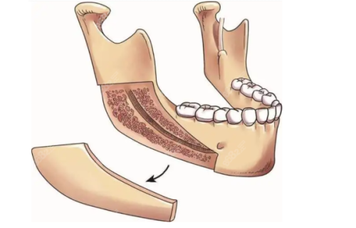 娄寅医生口碑评价及真人实例