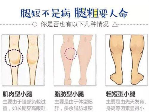 祖开慧医生技术优势