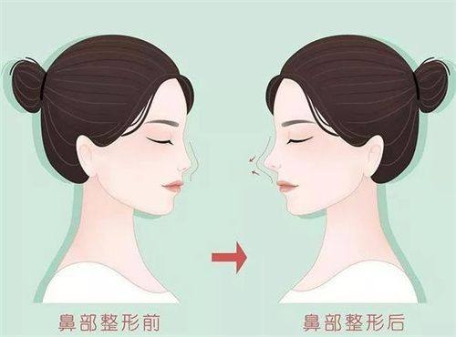 徐爱兵医生技术优势