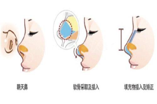 谢娟医生坐诊医院