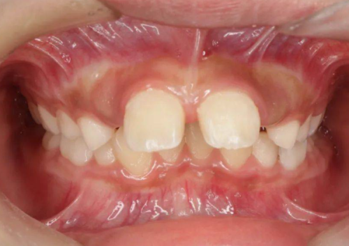 口碑评价及真人实例