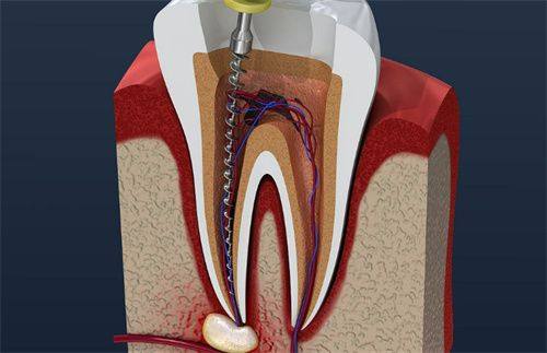 余姚康雅口腔真人口碑评价怎么样?