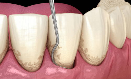 滨州医学校附属医院赵中华医生个人简介