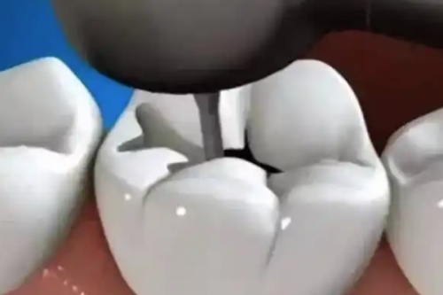 余姚康雅口腔地址电话营业时间