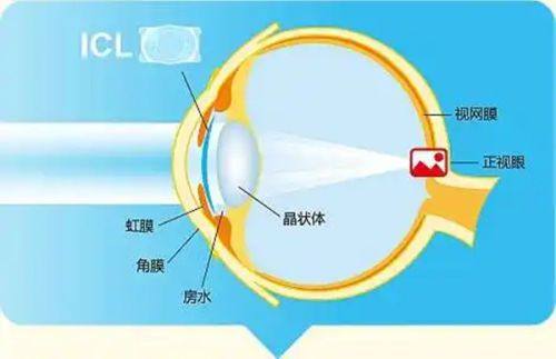叶进医生擅长项目