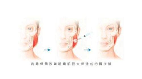 徐爱兵医生口碑评价及真人实例