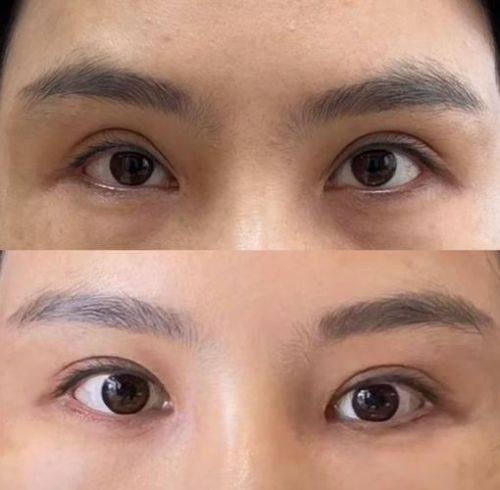 哈尔滨娇艾医疗美容诊所真人口碑评价怎么样？