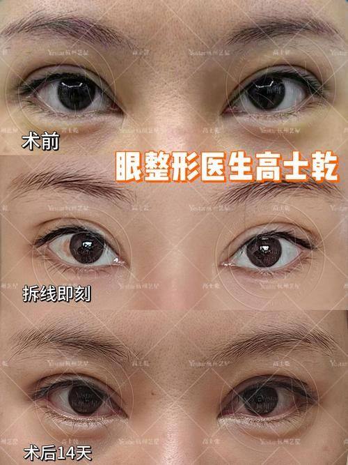 温州伯思立医疗美容医院是正规医院吗?