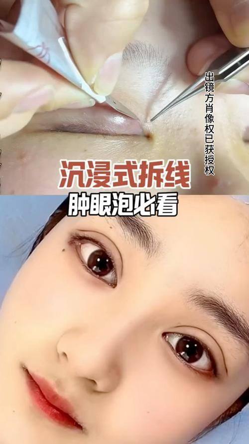 温州伯思立医疗美容医院真人口碑评价怎么样?