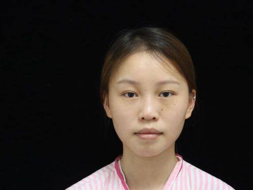 合肥博仕医疗美容门诊部真人口碑评价怎么样？