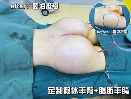 温州伯思立医疗美容医院特色项目及技术优势