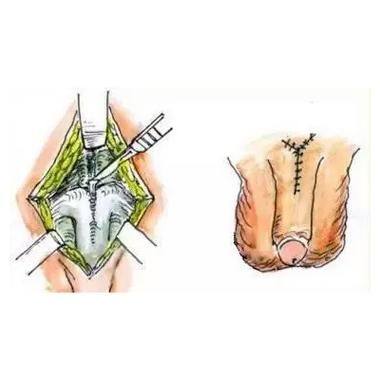 北京曙光医院医疗美容科特色项目及技术优势