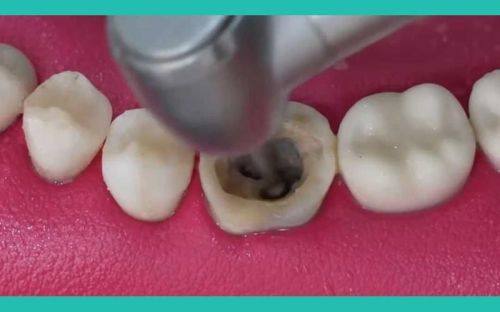 余姚康雅口腔收费价格表/收费标准