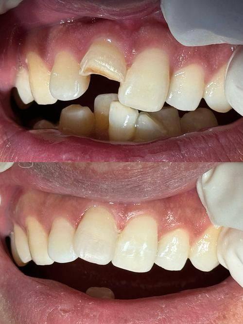 北京优贝口腔门诊部(门头沟旗舰院)真人口碑评价怎么样?