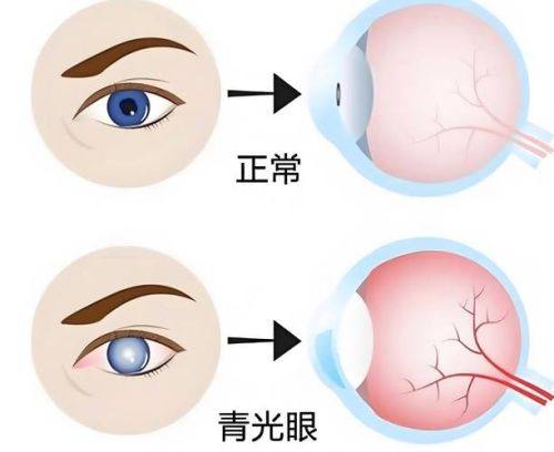 龙岩市第二医院眼科真人口碑评价怎么样?