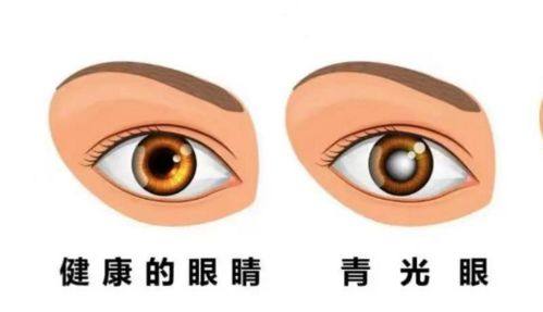 重庆宏仁一医院眼科特色项目及技术优势