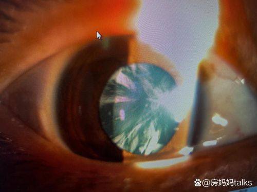 重庆宏仁一医院眼科地址电话营业时间