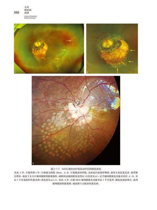 龙岩市第二医院眼科医生团队实力强大及骨干医生简介