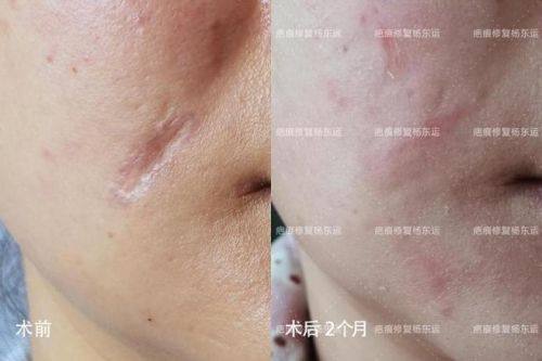 珠海广肤皮肤专科地址电话营业时间