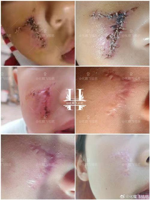 北京曙光医院医疗美容科收费价格表