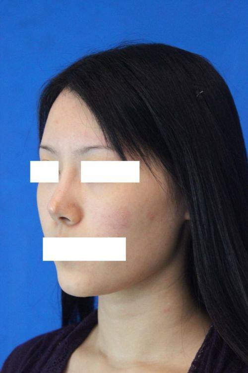 合肥博仕医疗美容门诊部特色项目及技术优势